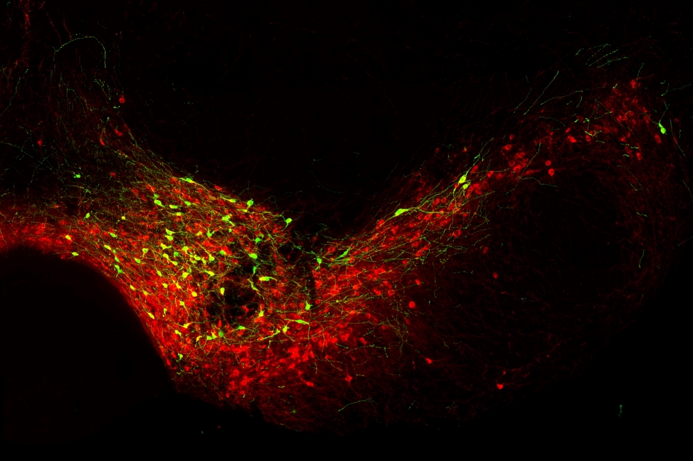 Dopaminerge Neurone im Mittelhirn einer Maus (rot): Grün erscheinen die Nervenzellen, die den Transkriptionsfaktor BCL11A produzieren.