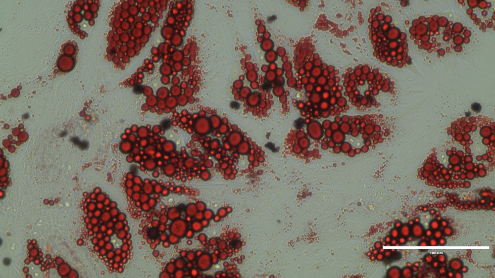 Humane braune Adipozyten, rot gefärbtes Lipid (Oil Red O-Färbung)