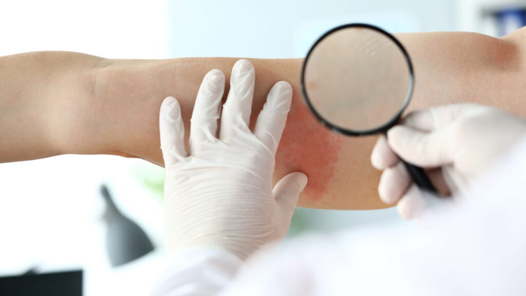 Umweltmedizinischer Ansatz bei Hautkrankheiten-