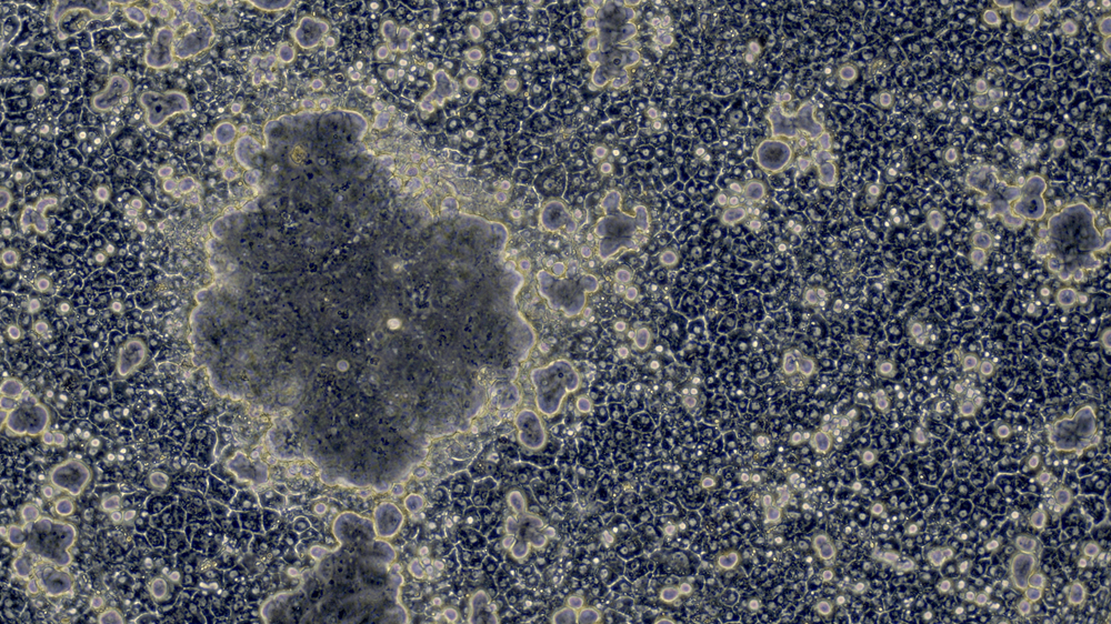 Wenn das CDX2-Netzwerk aktiv ist, bilden die Stammzell-Leberzellen ungewöhnlich große Gallenkanälchen mit Darmenzymen.